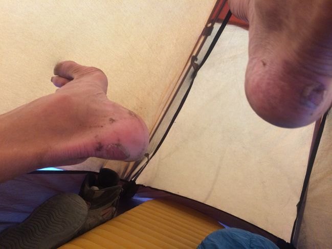 76 miles on these two blisters...
