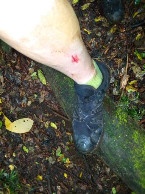12/12/23 Ray's leg after slip and collision with a big root  in Parque National de Ambre
